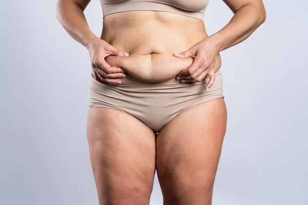 Women with flabby skin on her tummy