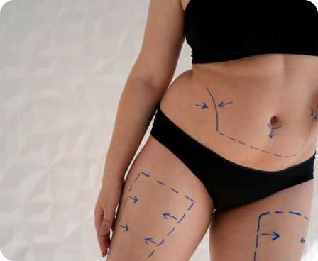 Body contouring procedures illustration